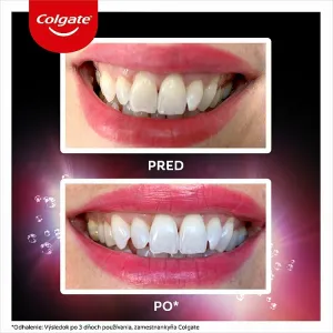 Colgate Max White Ultra Active Foam bieliaca zubná pasta 50ml