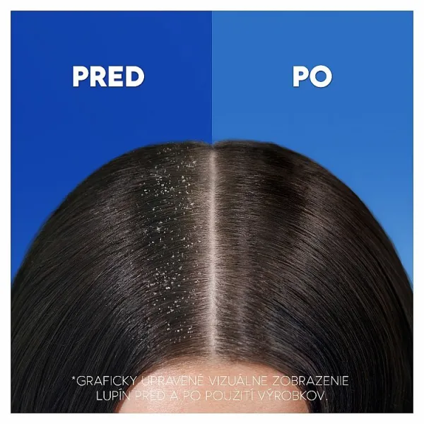 Šampón proti lupinám Head & Shoulders Apple Fresh, až 100 % bez lupín, 400ml