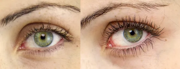 Nanolash Eyelash Serum Sérum-kondicionér pre rast rias 3 ml