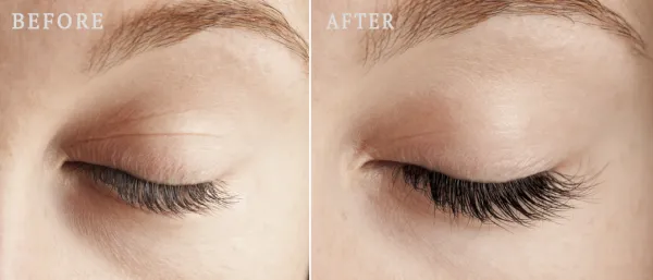 Nanolash Eyelash Serum Sérum-kondicionér pre rast rias 3 ml