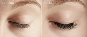 Nanolash Eyelash Serum Sérum-kondicionér pre rast rias 3 ml