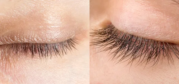 Nanolash Eyelash Serum Sérum-kondicionér pre rast rias 3 ml