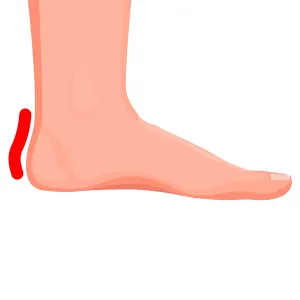 1 pár pätiek z pamäťovej peny