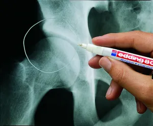 Röntgenový popisovač edding 8010 biely