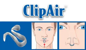 ClipAir - nosný dilatátor Veľkosť: S