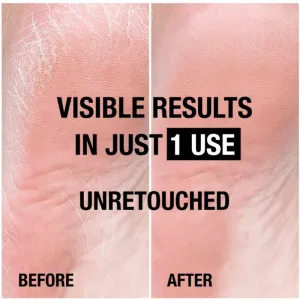 Neutrogena Norwegian Formula® regeneračný balzam na chodidlá 50 ml