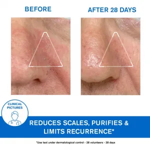 Uriage DS Regulating Soothing Emulsion upokojujúca emulzia na seboroickú dermatitídu 40 ml