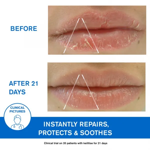Uriage DS Regulating Soothing Emulsion upokojujúca emulzia na seboroickú dermatitídu 40 ml