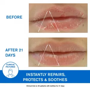 Uriage DS Regulating Soothing Emulsion upokojujúca emulzia na seboroickú dermatitídu 40 ml
