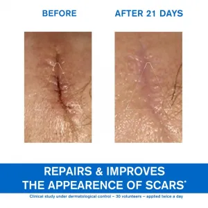 URIAGE Regeneračný krém (Bariederm Cica Crème) 40 ml