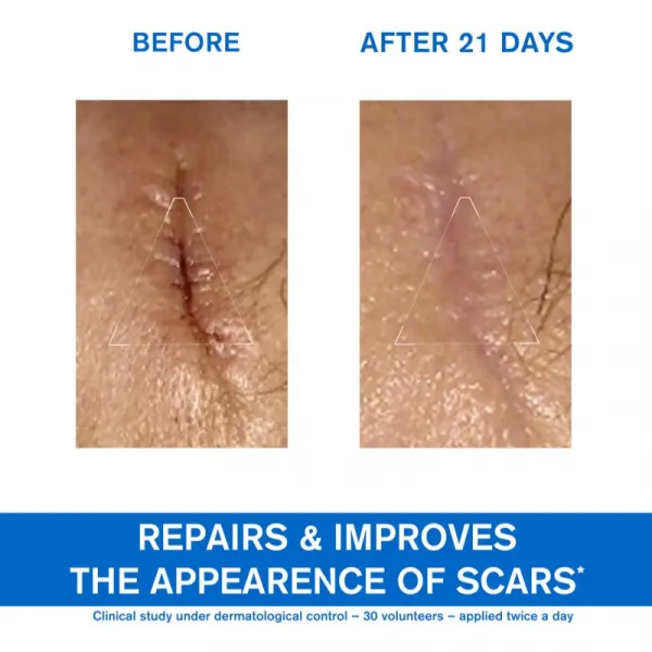 URIAGE Reparatívny krém s obsahom medi a zinku Bariéderm Cica (Repairing Cica-Cream With Cu-Zn) 100 ml