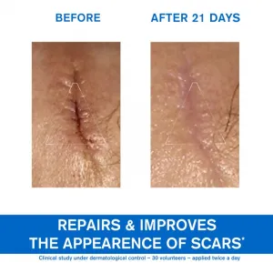 URIAGE Reparatívny krém s obsahom medi a zinku Bariéderm Cica (Repairing Cica-Cream With Cu-Zn) 100 ml