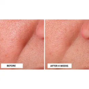 Perricone MD Cold Plasma Plus+ Advanced Serum vyživujúce sérum na tvár 30 ml