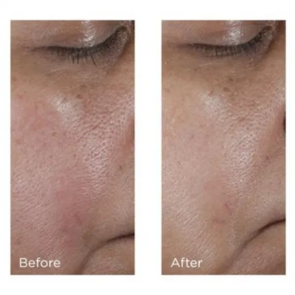 Perricone MD No:Rinse Pore Minimizing Toner intezívne tonikum pre vyhladenie pleti a minimalizáciu pórov 118 ml