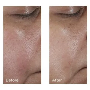 Perricone MD No:Rinse Pore Minimizing Toner intezívne tonikum pre vyhladenie pleti a minimalizáciu pórov 118 ml