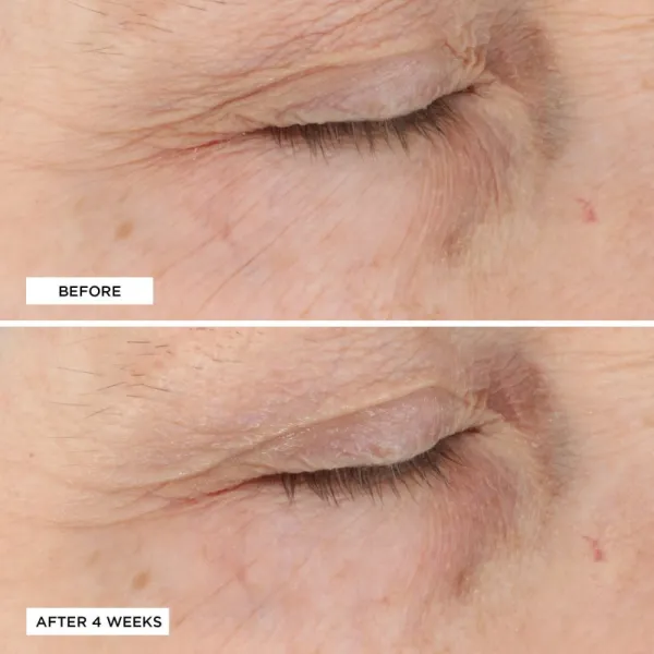 Perricone MD Essential Fx Acyl-Glutathione Moisturizer omladzujúci hydratačný krém proti vráskam 30 ml