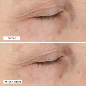 Perricone MD Essential Fx Acyl-Glutathione Moisturizer omladzujúci hydratačný krém proti vráskam 30 ml