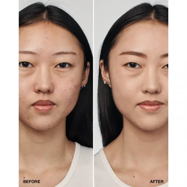 Clinique Even Better™ Clinica Serum Foundation ošetrujúci make-up SPF 20 odtieň CN 28 Ivory 30 ml