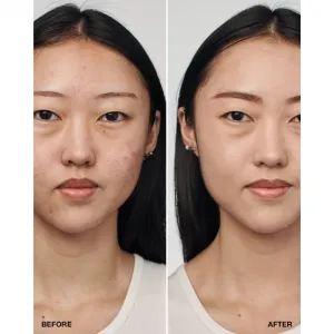Clinique Even Better™ Clinica Serum Foundation ošetrujúci make-up SPF 20 odtieň CN 28 Ivory 30 ml
