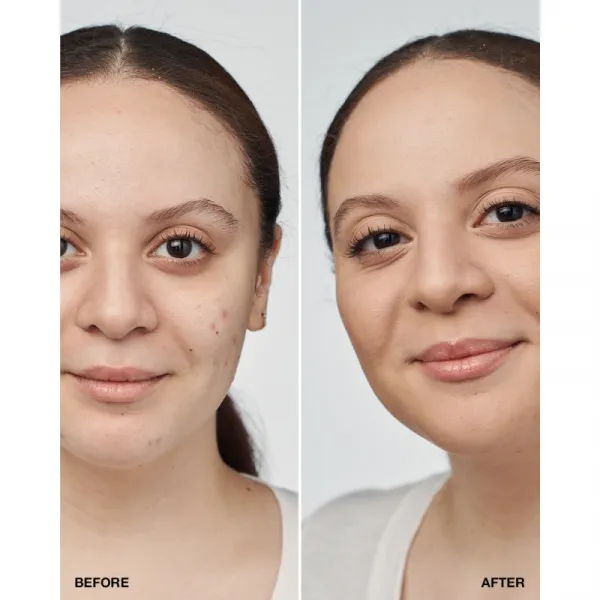 Clinique Even Better™ Clinica Serum Foundation ošetrujúci make-up SPF 20 odtieň CN 52 Neutral 30 ml