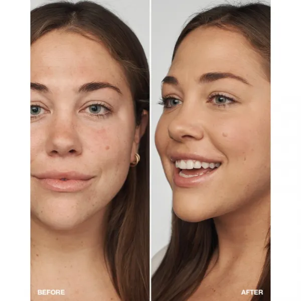 Clinique Even Better™ Clinica Serum Foundation ošetrujúci make-up SPF 20 odtieň WN 46 Golden Neutral 30 ml