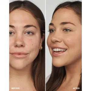 Clinique Even Better™ Clinica Serum Foundation ošetrujúci make-up SPF 20 odtieň WN 46 Golden Neutral 30 ml