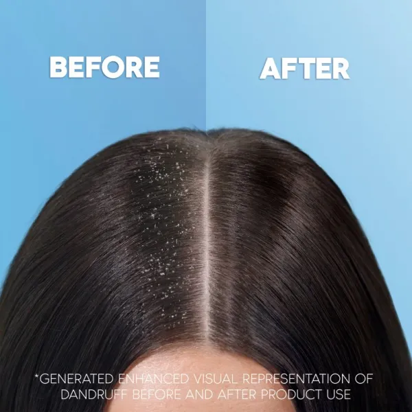 Head & Shoulders Extra Volume šampón proti lupinám 400 ml