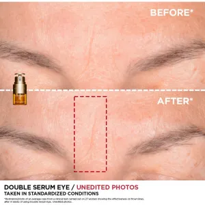 Clarins Double Serum Eye protivráskové sérum na očné okolie s vyživujúcim účinkom 20 ml