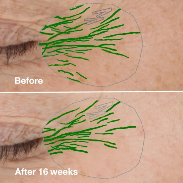 Clinique Smart Clinical™ Repair Wrinke Correcting Serum pleťové sérum na korekciu vrások 30 ml