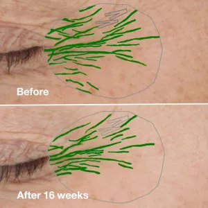 Clinique Smart Clinical™ Repair Wrinke Correcting Serum pleťové sérum na korekciu vrások 30 ml