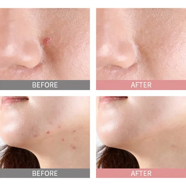Mizon Good Bye Blemish Pink Spot lokálne sérum proti akné proti akné 19 ml