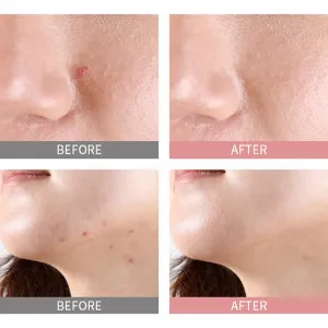 Mizon Good Bye Blemish Pink Spot lokálne sérum proti akné proti akné 19 ml