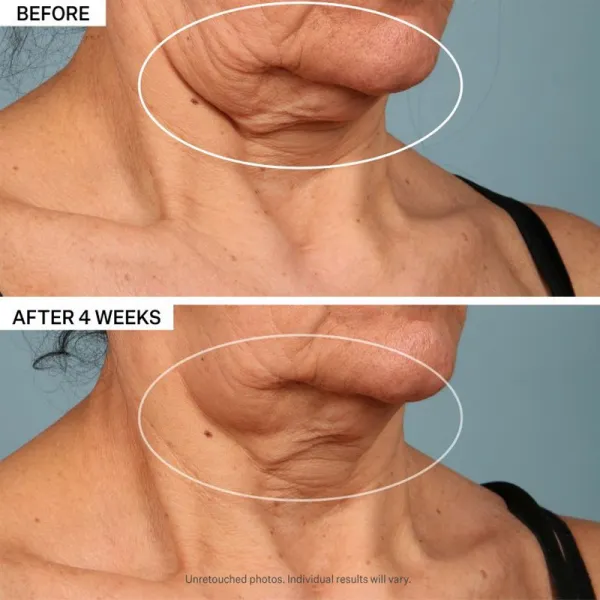 StriVectin Tighten & Lift TL Advanced Tightening Neck Cream Plus liftingový spevňujúci krém na krk a dekolt 30 ml