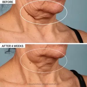 StriVectin Tighten & Lift TL Advanced Tightening Neck Cream Plus liftingový spevňujúci krém na krk a dekolt 30 ml