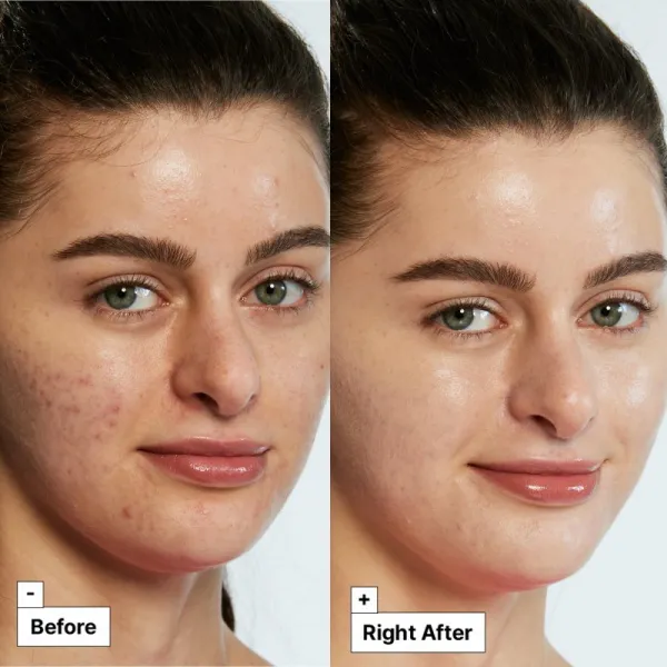Dr. Jart+ Cicapair™ Tiger Grass Color Correcting Treatment intenzívny krém redukujúci začervenanie pleti 15 ml