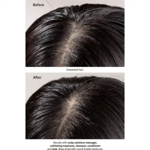 Aveda Scalp Solutions Exfoliating Scalp Treatment exfoliačný gél pre obnovu pokožky hlavy 25 ml