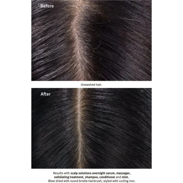 Aveda Scalp Solutions Exfoliating Scalp Treatment exfoliačný gél pre obnovu pokožky hlavy 150 ml