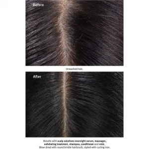 Aveda Scalp Solutions Exfoliating Scalp Treatment exfoliačný gél pre obnovu pokožky hlavy 150 ml