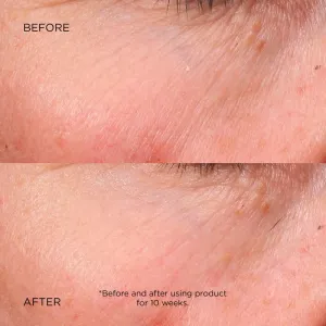 Darphin Éclat Sublime Dual Rejuvenating Micro-Serum omladzujúce regeneračné sérum 30 ml
