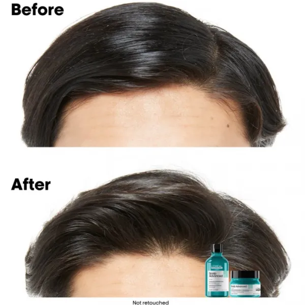 L’Oréal Professionnel Serie Expert Scalp Advanced šampón a maska 2 v 1 pre mastné vlasy a vlasovú pokožku 250 ml