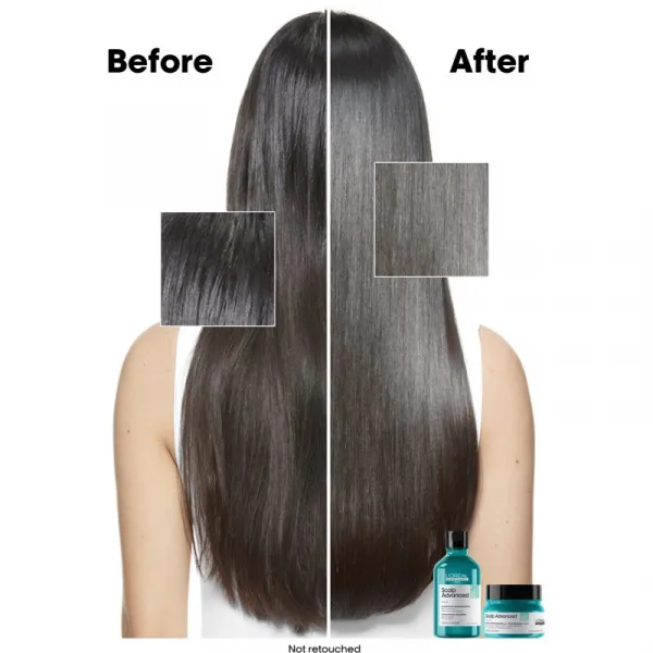 L'Oréal Professionnel Paris šampón na vlasy - Scalp Advanced Anti-Oiliness Dermo-Purifier Shampoo
