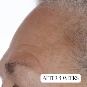Perricone MD Essential Fx Acyl-Glutathione Chia Face Oil ľahký olej proti vráskam 30 ml