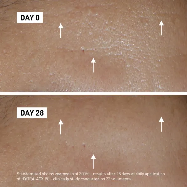 FILORGA HYDRA-AOX intenzívne sérum s antioxidačným účinkom 30 ml