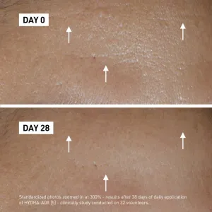 FILORGA HYDRA-AOX intenzívne sérum s antioxidačným účinkom 30 ml