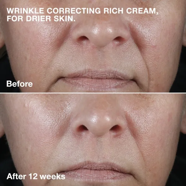 Clinique Smart Clinical™ Repair Wrinkle Correcting Cream vyživujúci protivráskový krém 75 ml