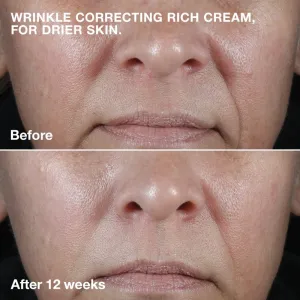 Clinique Smart Clinical™ Repair Wrinkle Correcting Cream vyživujúci protivráskový krém 75 ml