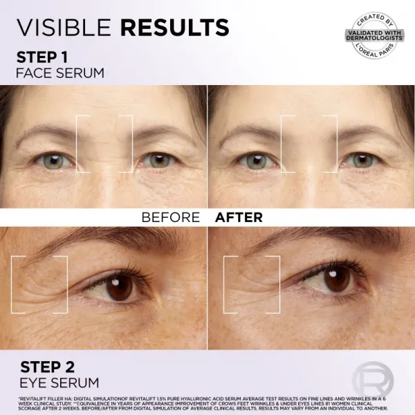 L’Oréal Paris Revitalift Filler sada pre starostlivosť o pleť na tvár a očné okolie