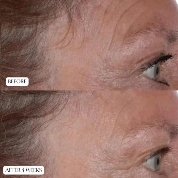 Perricone MD Cold Plasma Plus+ The Essence pleťová esencia 140 ml