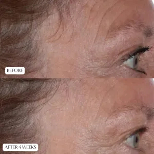 Perricone MD Cold Plasma Plus+ The Essence pleťová esencia 140 ml