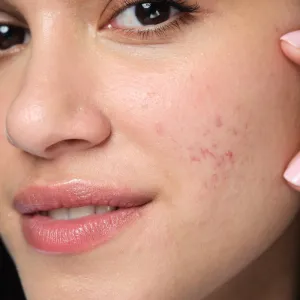 Neutrogena Clear & Defend+ chemický peeling 125 ml